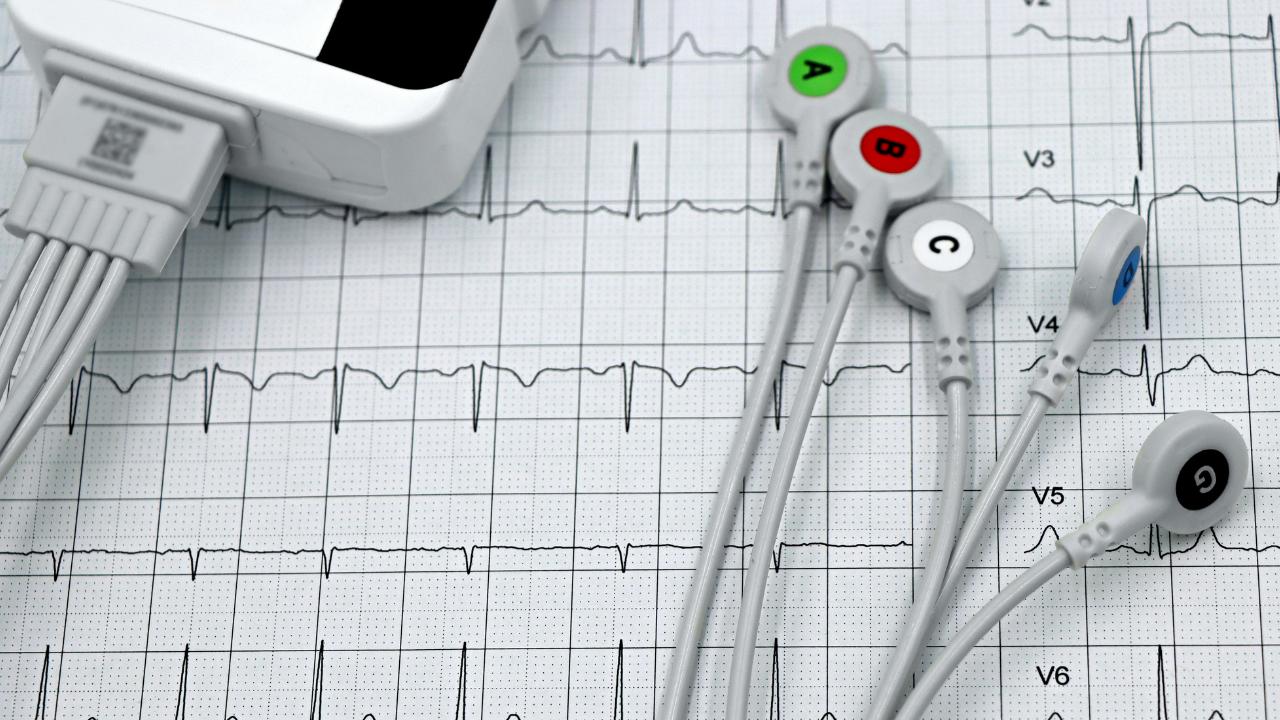 ECG 
