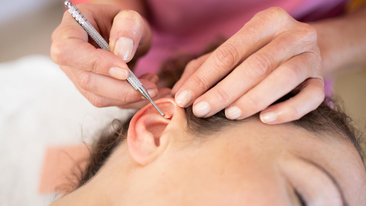 Auriculoterapia